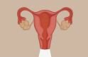 Как протекают менструации во время менопаузы