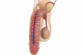 Методы лечения импотенции на фоне хронического простатита