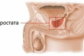 Что провоцирует развитие простатита