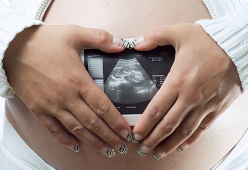 беременная женщина со снимком