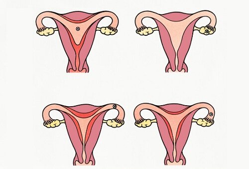 Изменения менструального цикла